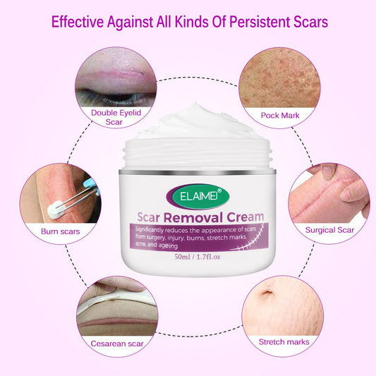 Skin Rebound Scarless Cream Scar Removal Cream Face Cream For Face Acne Scar Stretch Marks Skin Repair Face Cream | Luxury Home Accessories | Heulog Glow