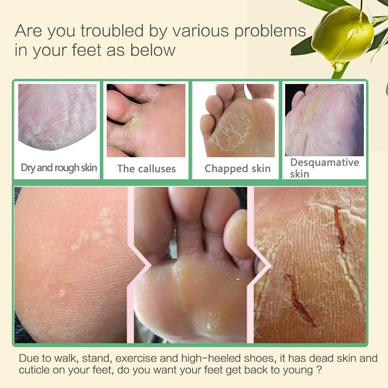 Aloe Vera Foot Mask Peeling For Legs Feet Mask Exfoliating Socks Scrub For Pedicure Anti Crack Heel Remove Skin Foot Patch | Luxury Home Accessories | Heulog Glow