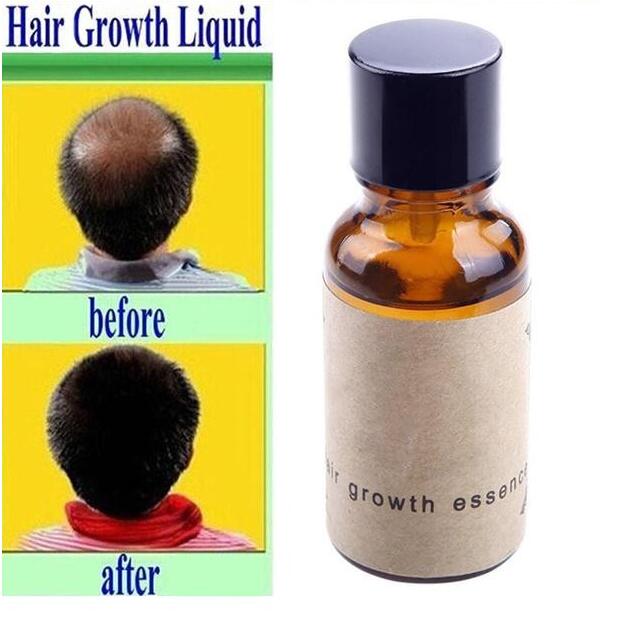 Hair growth liquid | Luxury Home Accessories | Heulog Glow