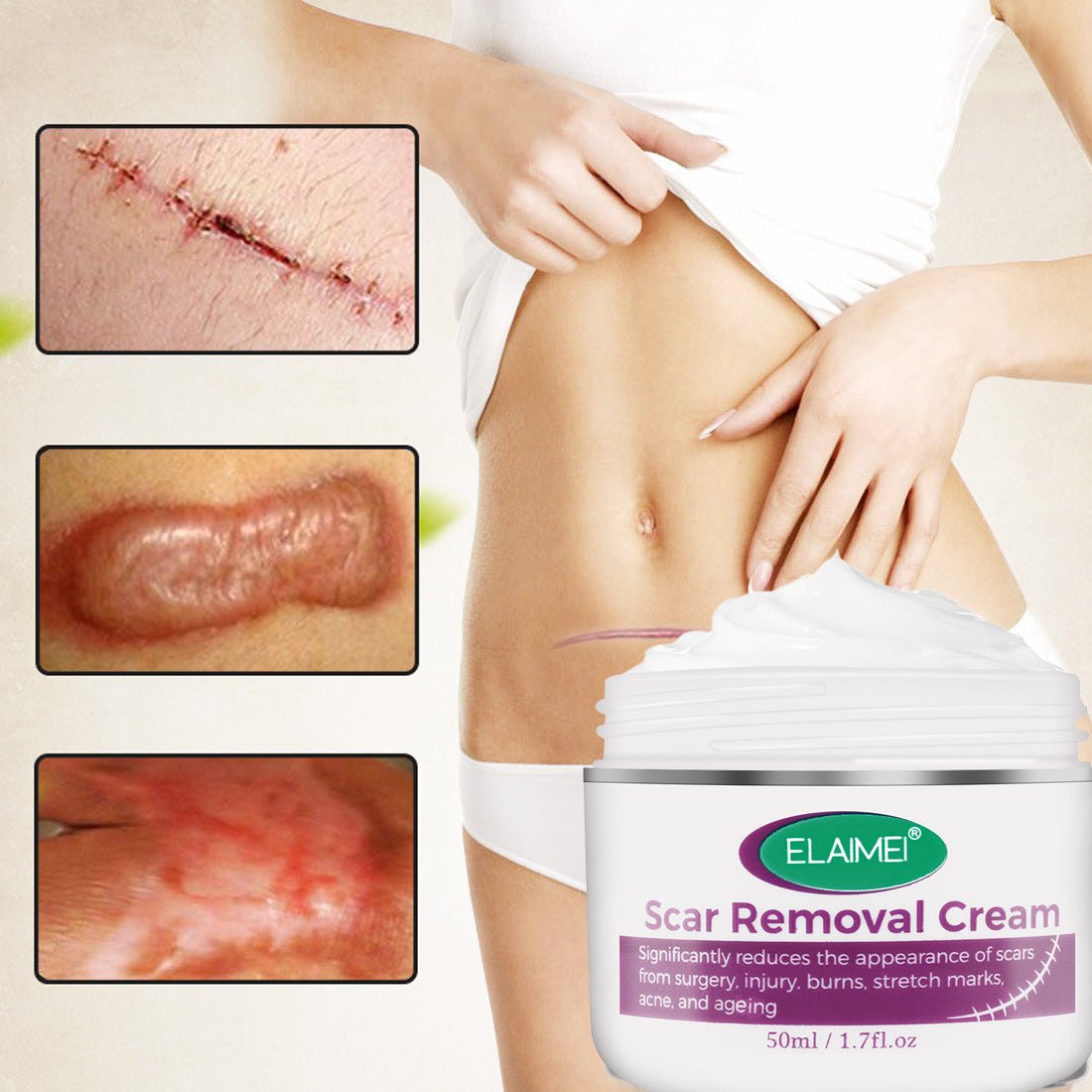 Skin Rebound Scarless Cream Scar Removal Cream Face Cream For Face Acne Scar Stretch Marks Skin Repair Face Cream | Luxury Home Accessories | Heulog Glow